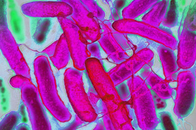 Antibiyotik Dirençli Bakteriler Hızla Yayılıyor: Dünya Sağlık Örgütü’nden Küresel Uyarı